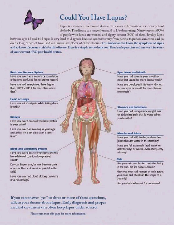 Could you have Lupus?