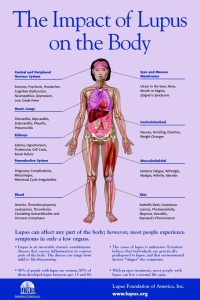 The impact of Lupus on the body